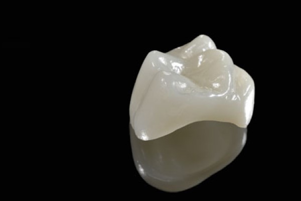 CEREC Crowns Compared To Other Restorations