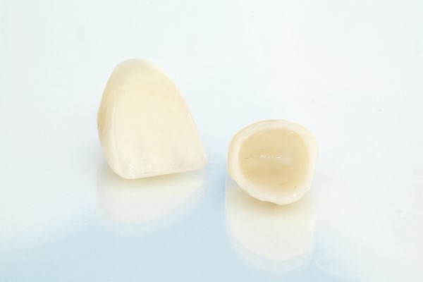 What Materials Are CEREC® Crowns Made Of?