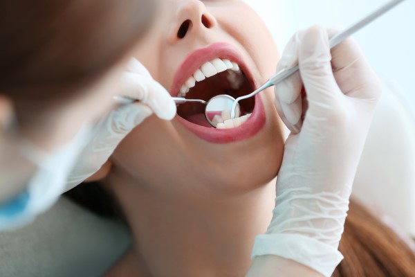 The FAQs Of A Deep Teeth Cleaning