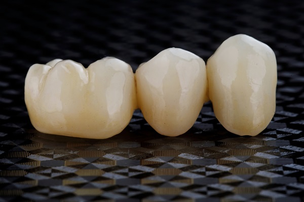 Why Dental Bridges Are An Effective Tooth Restoration