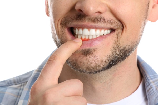 Gum Disease Treatment Options: From Deep Cleanings To Ongoing Maintenance