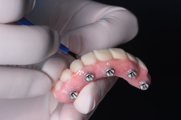 Implant Supported Dentures Carmichael, CA