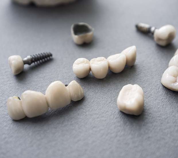 Carmichael The Difference Between Dental Implants and Mini Dental Implants