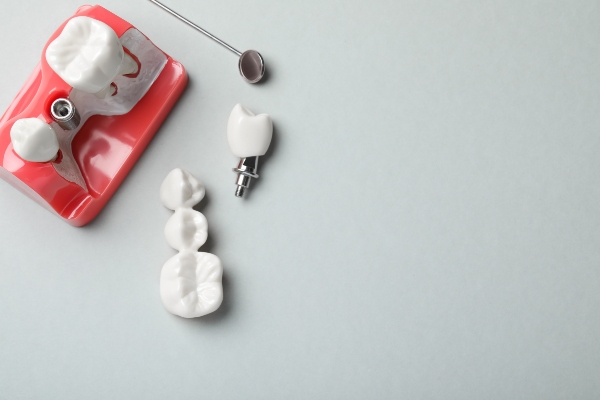 How A Restorative Dentist Helps Rebuild Your Smile