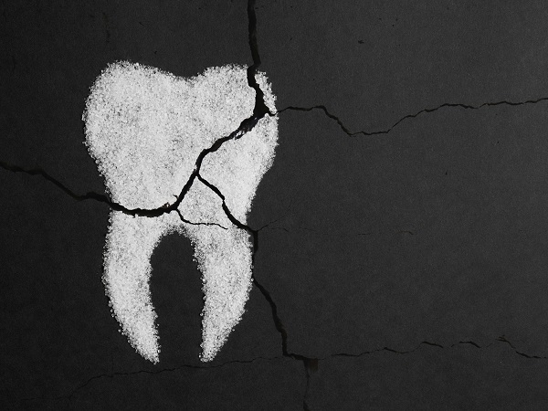 Tooth Decay Carmichael, CA